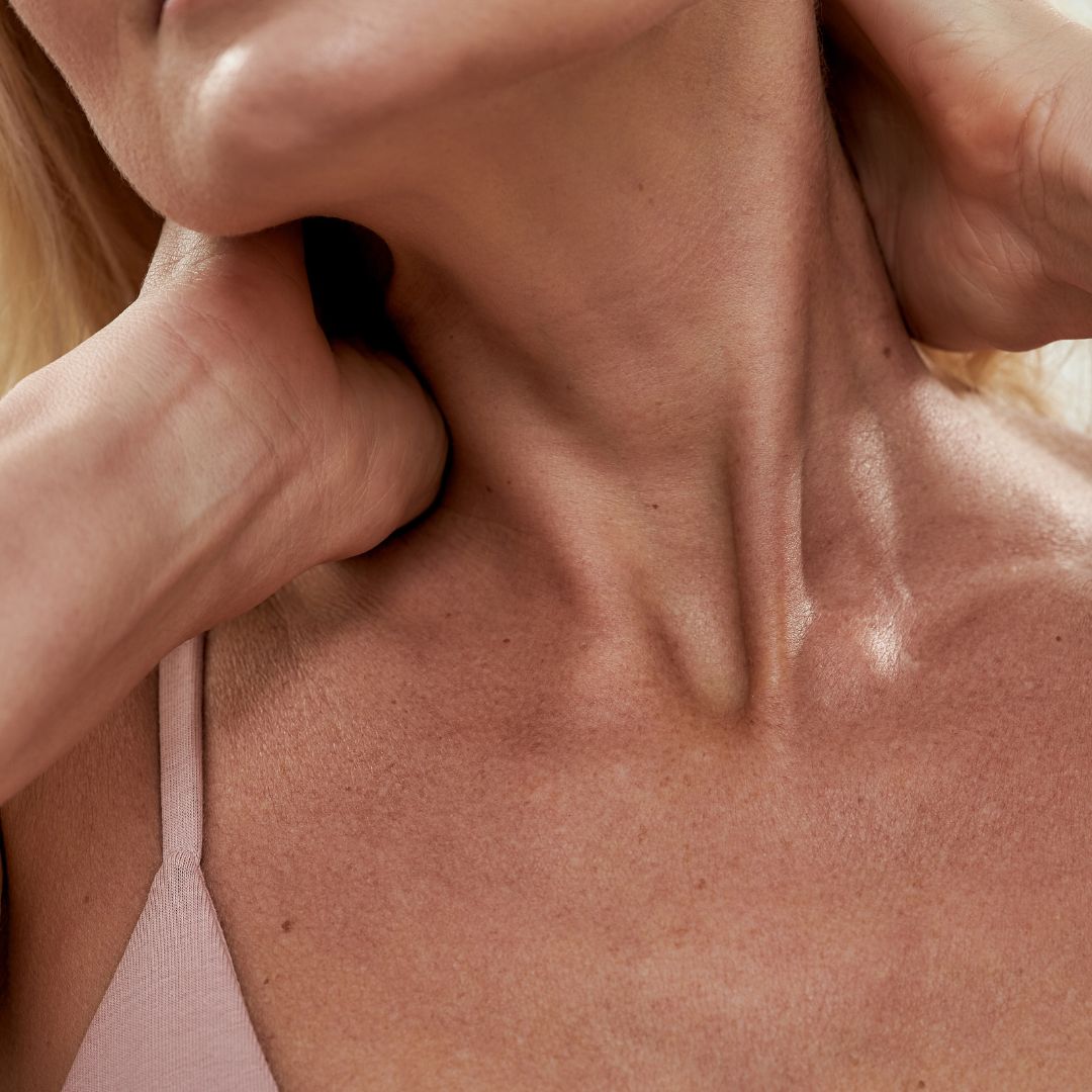 How to Treat and Care for Your Neck